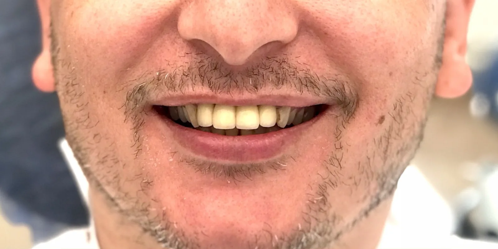 Önce