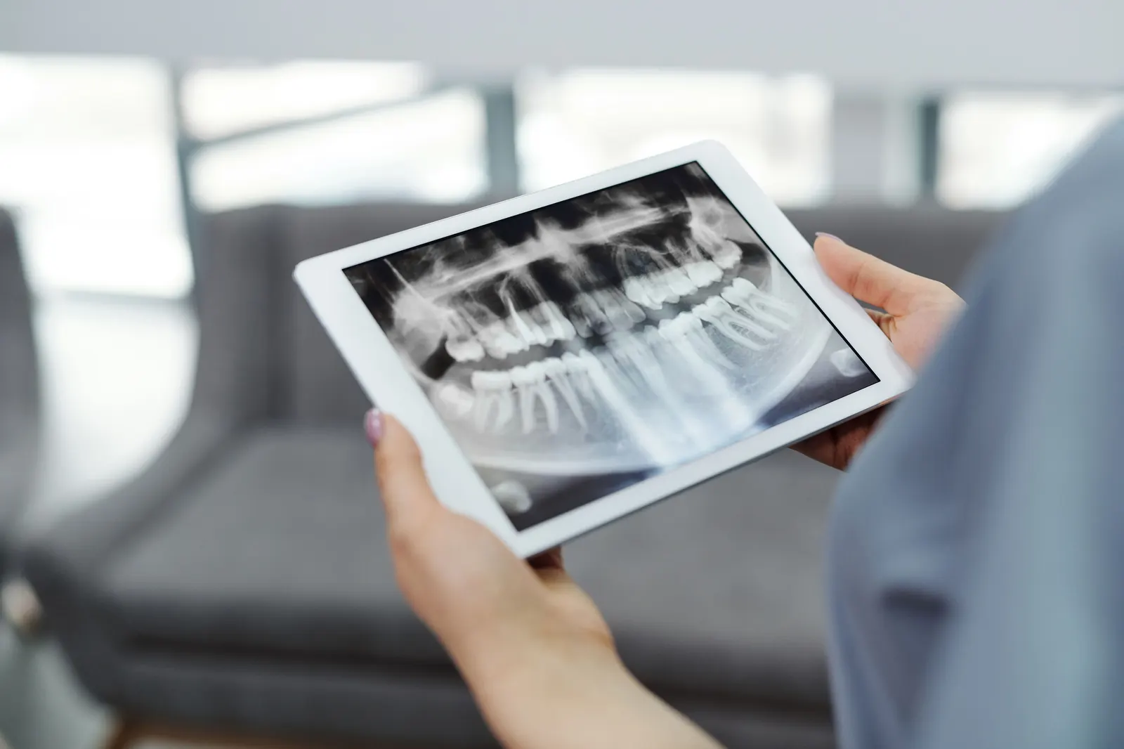 Zahnbehandlung türkei — Implantat pass bei GC Clinic Istanbul