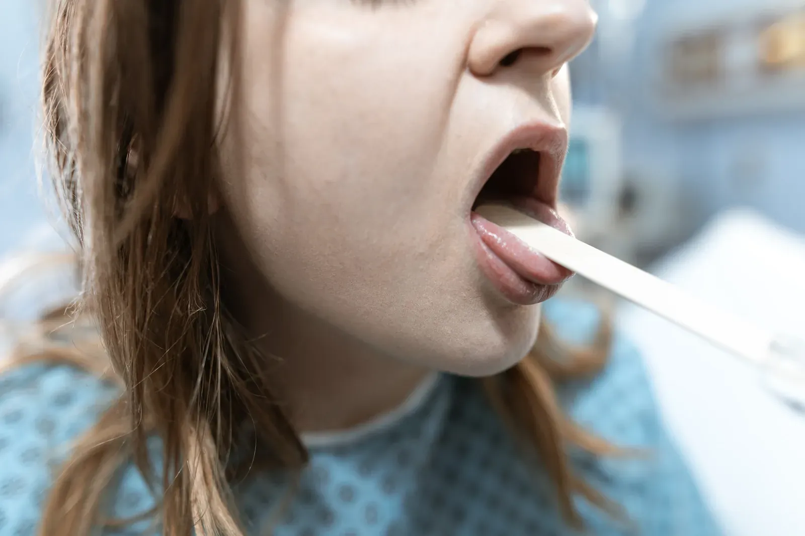 Aftas y úlceras bucales: cuándo consultar al dentista