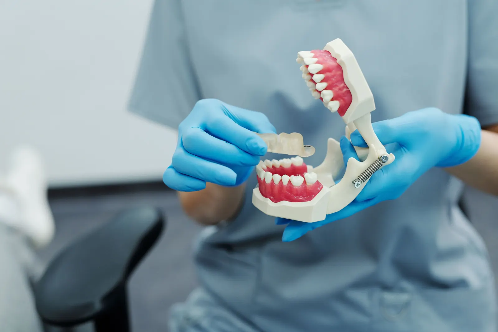 Bruxism dental wear — teeth grinding damage pattern