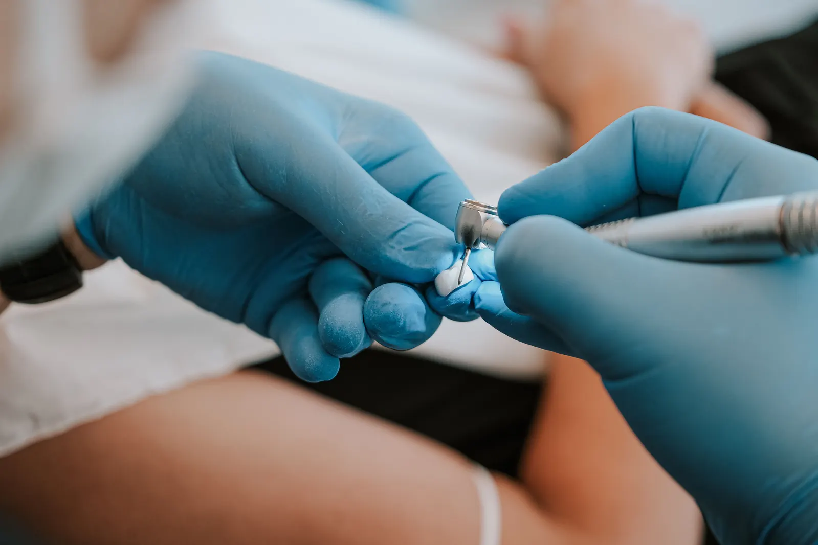Illustration de l'article sur couronne dentaire quand pourquoi — GC Clinic Istanbul