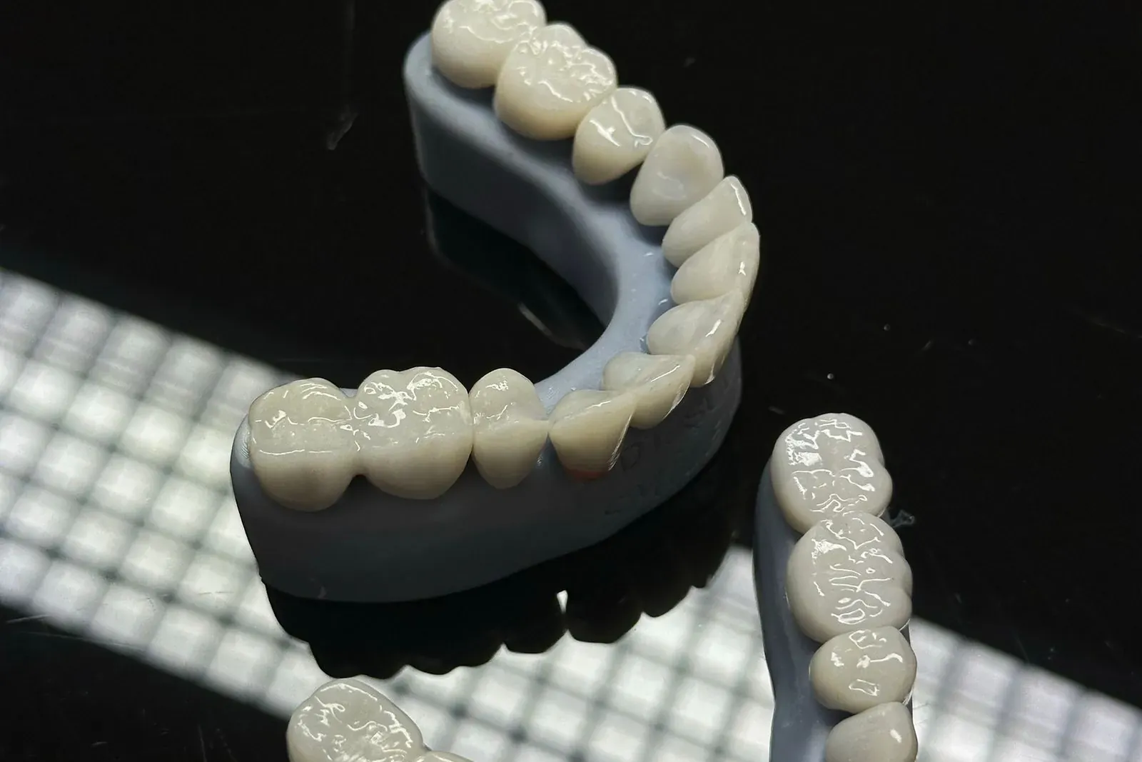 Dents limées en Turquie :ce que cela signifie vraiment.