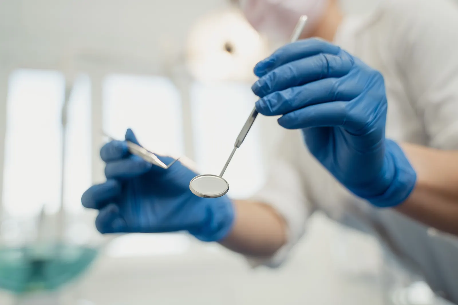 Esquema clínico de un alveolo con coágulo desplazado y exposición ósea — alveolitis seca