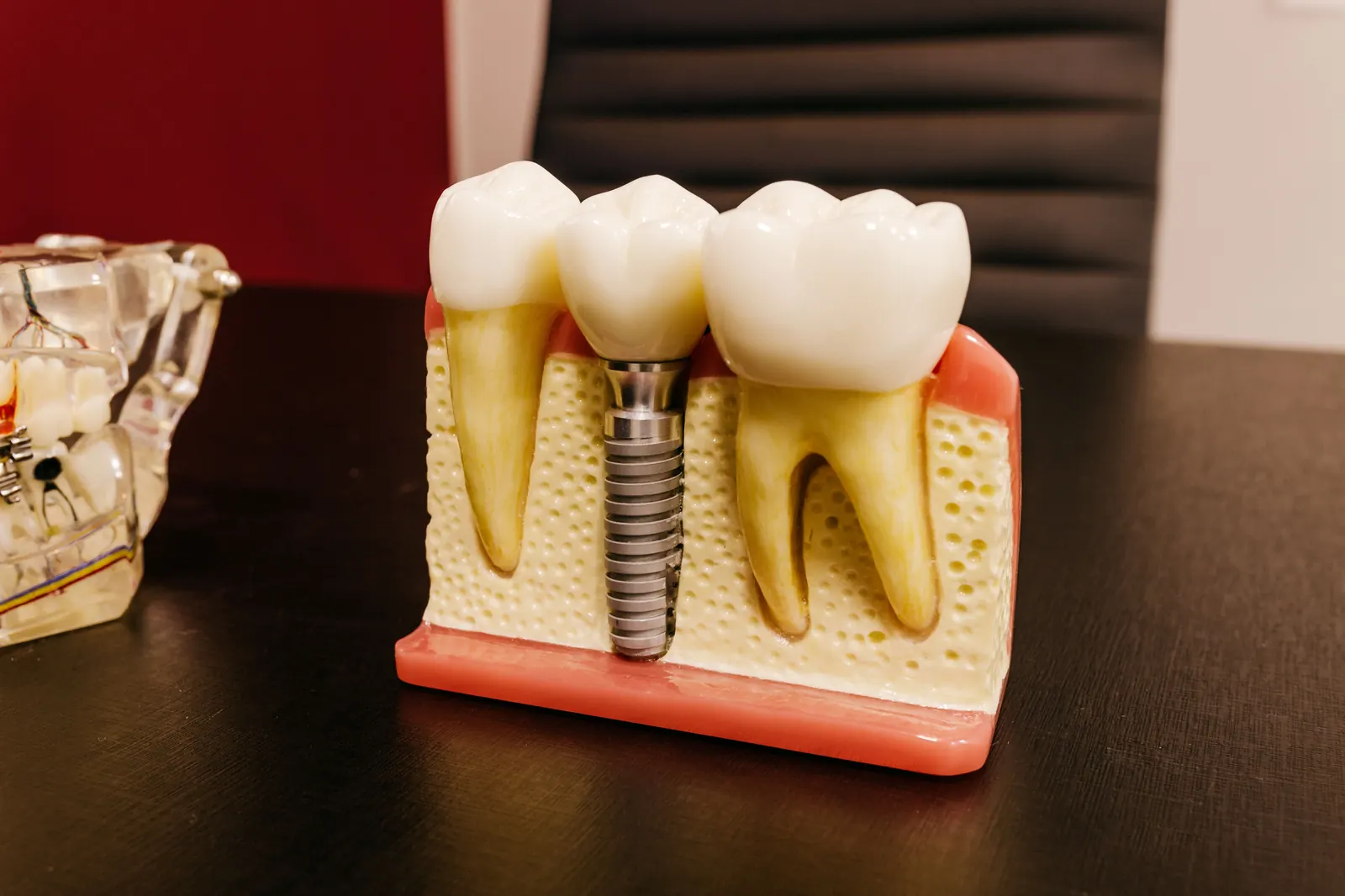 Gum disease symptoms — gingivitis to periodontitis progression signs