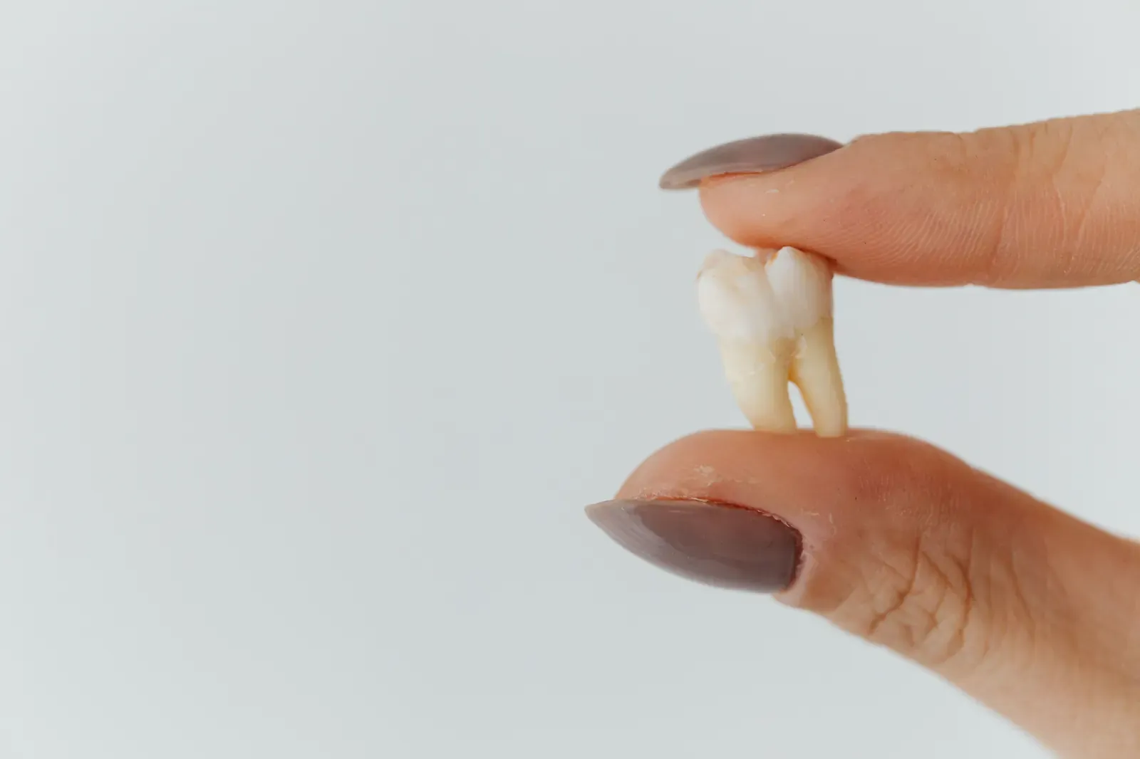 Istruzioni Post-Estrazione Dentale