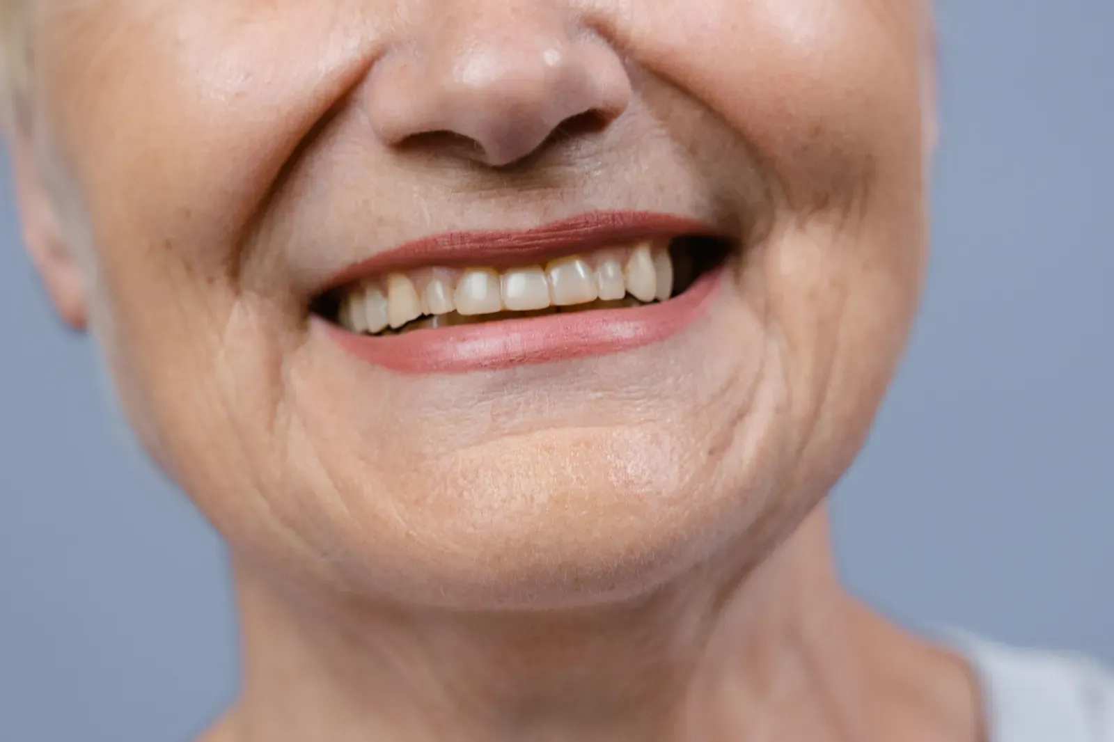 Natuurlijk Glimlachontwerp —De anti-Hollywood Smile beweging.