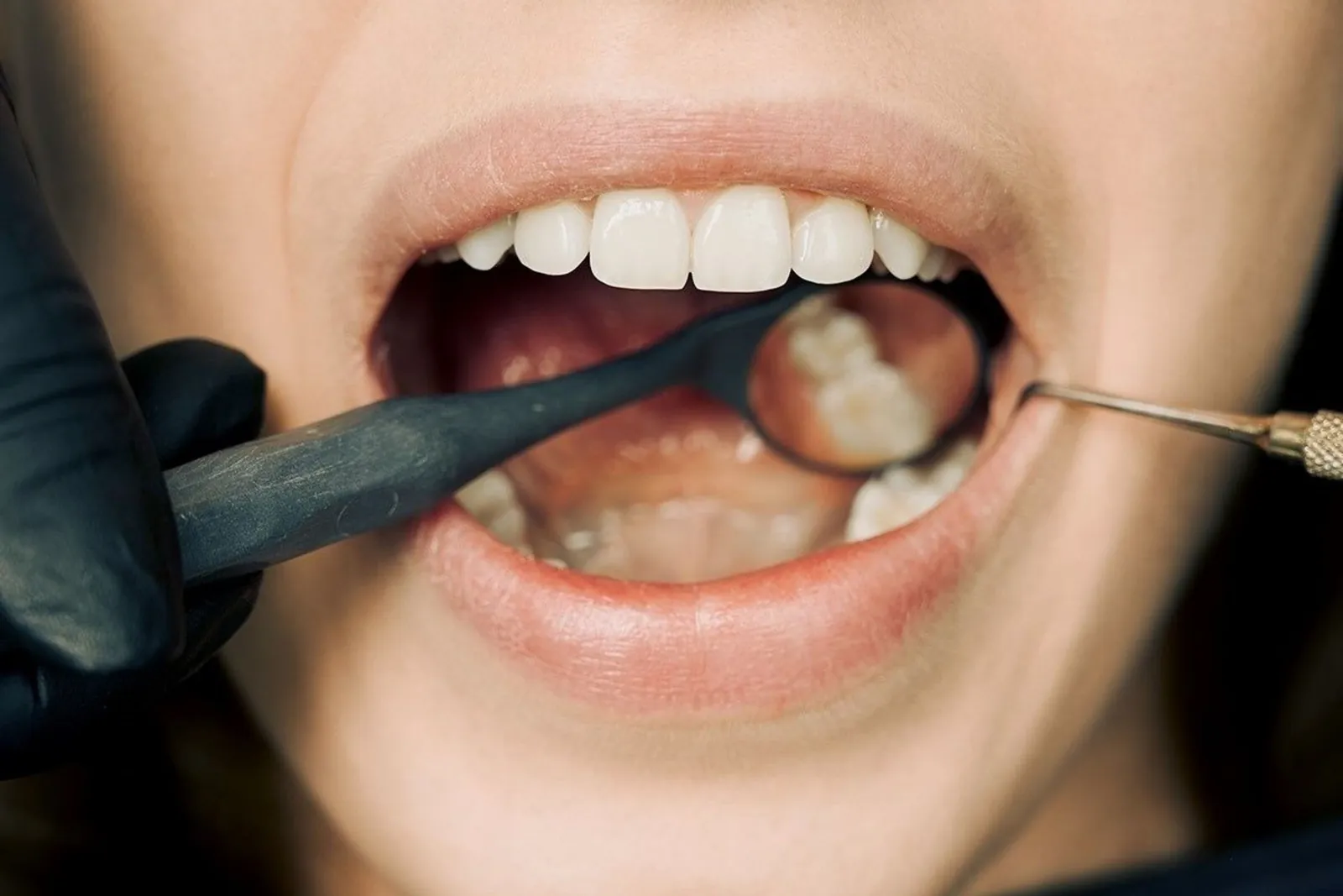 Common Oral Diseases and Conditions: A UK Patient Reference