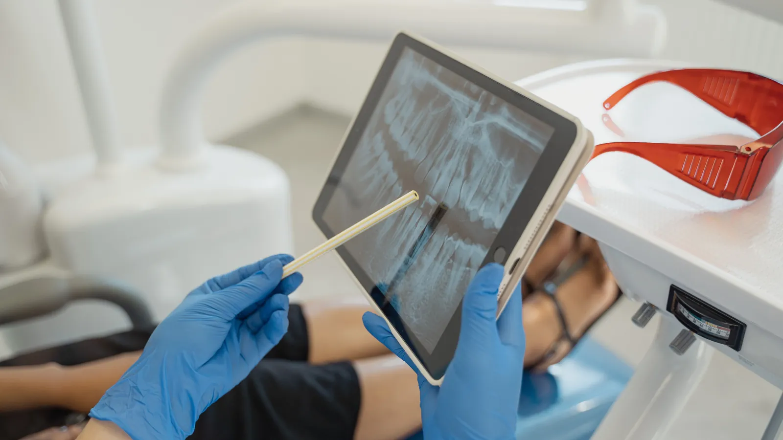 Befundbesprechung: Panoramaröntgen auf dem Tablet mit Zeigestift
