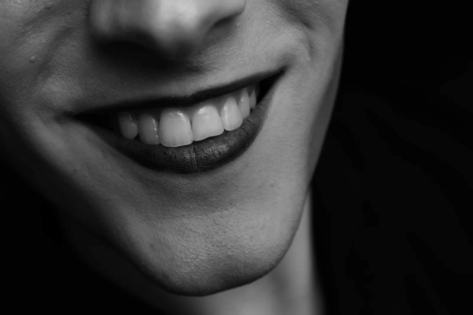 Professional teeth whitening — clinical bleaching procedure