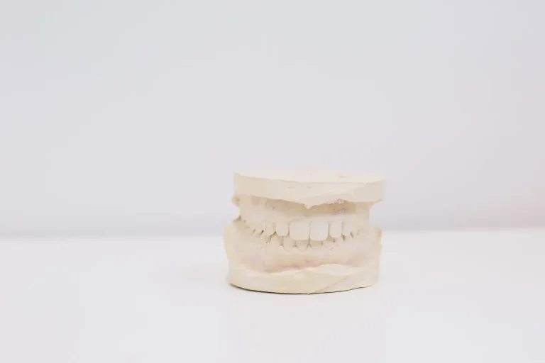 Tandlengte Verlenging — Oplossing voor Korte Tanden of Gummy Smile