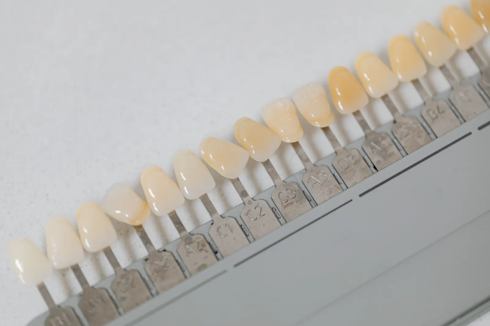 Patient consultation showing midline diastema treatment options at GC Clinic Istanbul